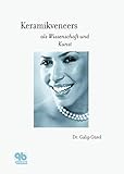 Keramikveneers als W