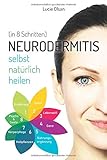 Neurodermitis selbst natürlich heilen (in 8 Schritten)