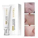 Mimiga Whitening Cream Whitening Serum Hautcreme Whitening Creme zum entfernen von Sommersprossen braunen Flecken Anti B