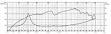 Visaton VS-BG17 – Lautsprecher (schwarz, TV/Monitor-Lautsprecher, 80 – 20000 Hz, 165 x 165 x 61,5 mm, MB 156/3)