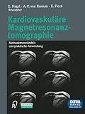Kardiovaskuläre Magnetresonanztomographie: Methodenverständnis und praktische Anwendung