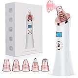 MixcMax Mitesserentferner Porenreiniger Mitesser Sauger Porenreiniger Elektrisch Blackhead Remover USB LED Vakuumsauger Gesichtsreinigung mit 5 Multifunktionssonde Roség