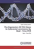 The Expression Of P53 Gene In Colorectal carcinoma By Real - Time PCR: Real – Time PCR