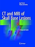 CT and MRI of Skull Base Lesions: A Diagnostic G