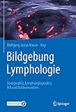 Bildgebung Lymphologie: Sonographie, Lymphangiographie, MR und Nuk
