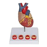 Anatomiemodell 1: 1 menschliches Herzmodell Herzklappe 4-stufiges Thrombusmodell für Display Wissenschaftslabor liefert Schulunterrichtswerkzeug