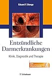 Entzündliche Darmerkrankungen: Klinik, Diagnostik und Therapie - Online: Videos zur Darmspiegelung mit typischen B