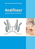 Analfissur: Symptome, Diagnose und Therap