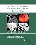 Atlas of Imaging of the Paranasal Sinuses, Second Edition (English Edition)