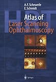 Atlas of Laser Scanning Ophthalmoscopy (English Edition)