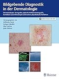 Bildgebende Diagnostik in der Dermatologie: Dermatoskopie, Konfokale Laserscanmikroskopie, Optische Kohärenztomografie, Sonog