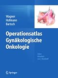Operationsatlas Gynäkologische Onkolog