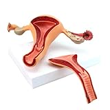 Bildungsmodell Uterusmodell - Weibliches Fortpflanzungssystem Anatomisches Modell - Abnehmbare wissenschaftliche Anatomie Uterus-Ovarialstruktur Medizinisches Modell - für medizinische Ausbildung