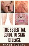 The Essential Guide To Skin Disease: Diagnosis And Treatment To The Most Common Skin Conditions (English Edition)