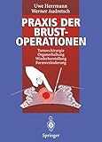 Praxis der Brustoperationen: Tumorchirurgie ― Organerhaltung ― Wiederherstellung ― Formveränderung