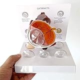 BZZBZZ Modell der Anatomie des menschlichen Auges - Modell der Katarakt-Augenkrankheit (Glaukom) mit 5 Hornhäuten für ophthalmologische Demonstrations-L