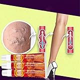 3pcs Advanced Varicose Remission Cream, Krampfadern Behandlung Für Beine Creme, Linderung Von Phlebitis Angiitis, Beruhigende Beincreme Mit Natürlicher Krampfader, Vaskulitis Komfortab