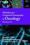 Multi-Detector Computed Tomography in Oncology: CT Perfusion Imaging