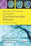 Multidetector Computed Tomography in Cerebrovascular Disease: CT Perfusion Imaging (English Edition)