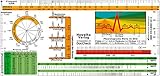 EKG Lineal -professional- II - inkl. Lagetypen, Lagekreis,