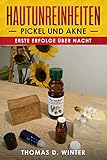 Hautunreinheiten - Pickel und Akne - Erste Erfolge über N