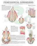 Periodontal disorders e chart: Full illustrated (English Edition)