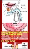 STOP BENIGN PROSTATIC HYPERPLASIA (BPH) : The Ultimate Guide On Healing Age-Associated Prostate Gland Enlargement That Can Cause Urination Difficulty (English Edition)