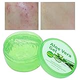 Akne ， Aloe Vera Feuchtigkeitsgel, Aloe Vera Feuchtigkeitsgel ， Feuchtigkeitsspendende Feuchtigkeitsspendende Pflege gegen Sonnenbrand TagespflegeFeuchtigkeitspfleg