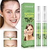 Acne Treatment, Akne Creme, Anti Pickel Creme, Gegen Pickel und unreine Haut für ein klareres Hautbild für Empfindliche Haut, Balance Wasser und Öl, Anti Pickel Creme für Frauen M